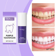 Whiten Teeth Naturally