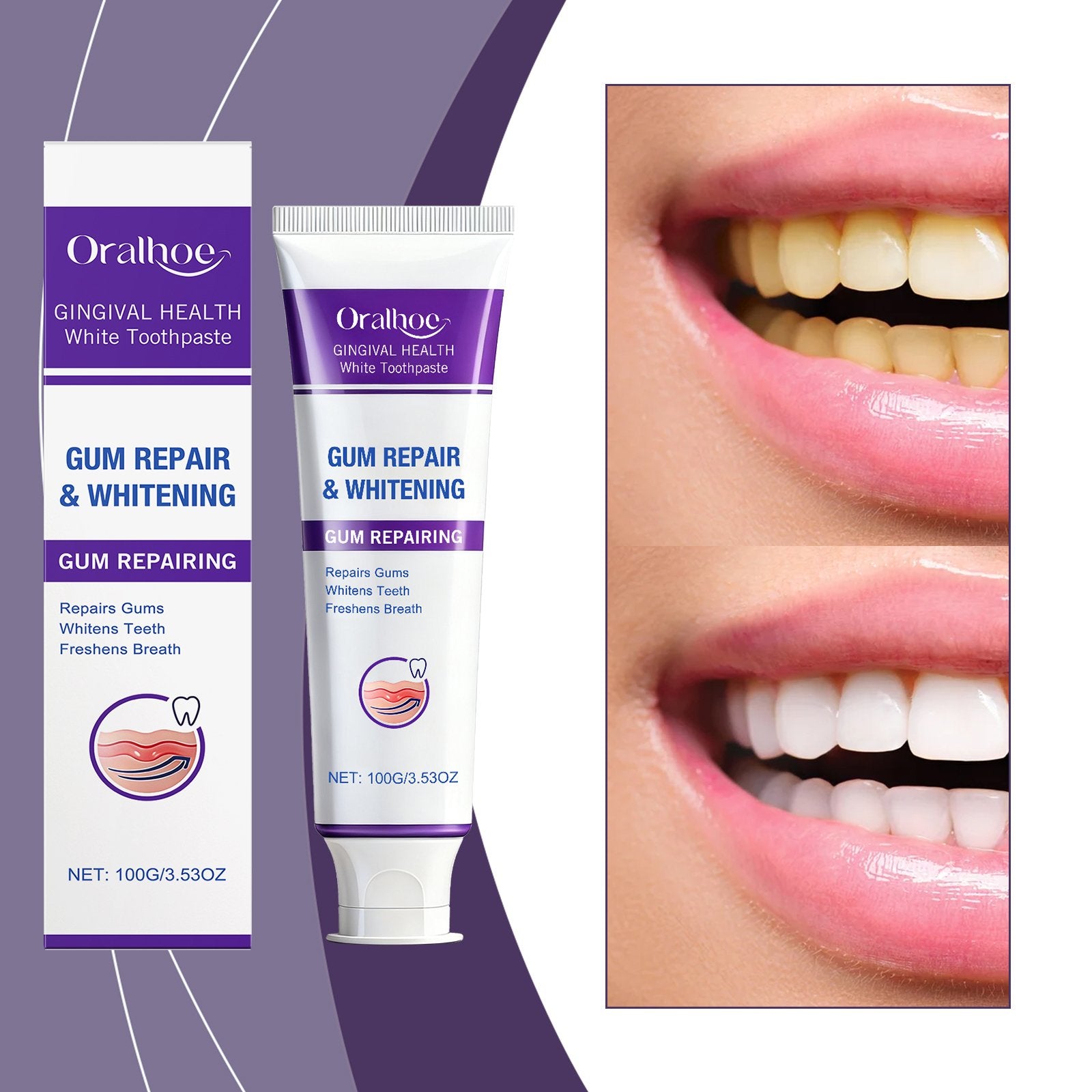 Brightening Toothpaste for Fresh Breath and Healthy Gums