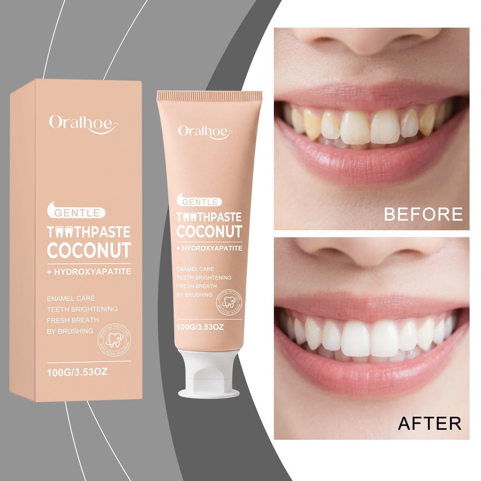 Whiten Teeth Naturally