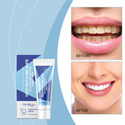Whiten & Clean Teeth
