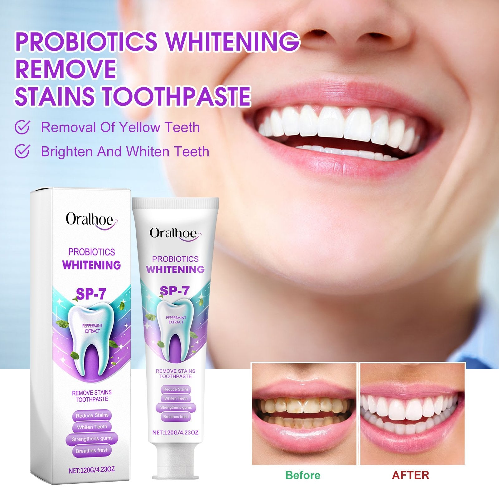 Whiten Teeth with Probiotics - 120g