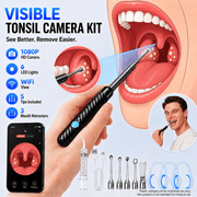 Oral Care Kit with LED Light Tonsil Stone Remover and 5 Attachments