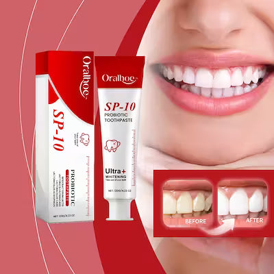 Probiotic Whitening Toothpaste 120g